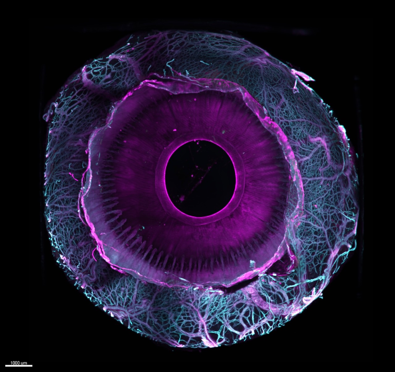 Light sheet fluorescence microscopy of cleared human eyes