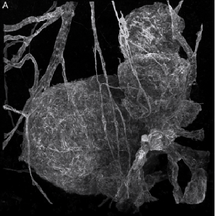 Confocal microscopy of telangiectatic capillaries (TelCaps) and other features of microvascular remodeling following branch retinal vein occlusion