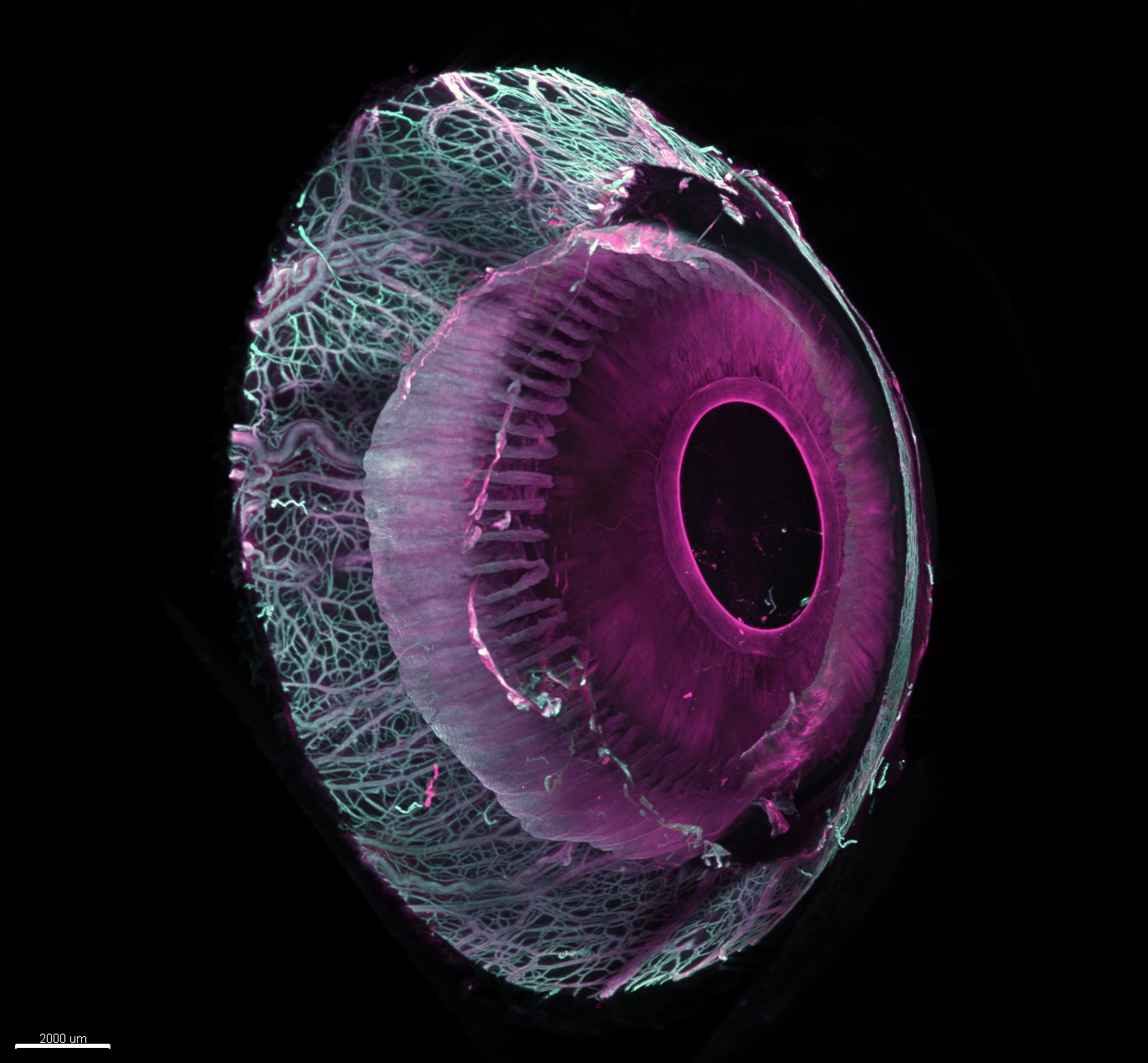 Light sheet fluorescence microscopy of cleared human eyes