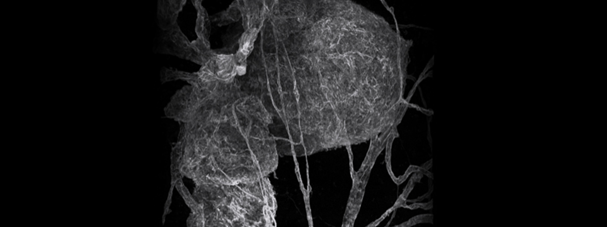 Confocal microscopy of TelCaps and other features of microvascular remodeling following BRVO