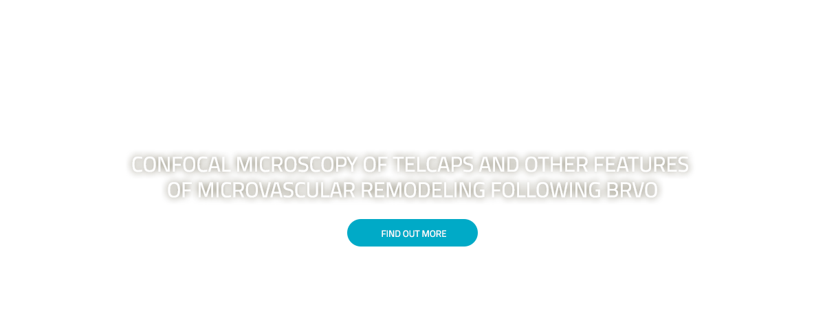 Confocal microscopy of TelCaps and other features of microvascular remodeling following BRVO